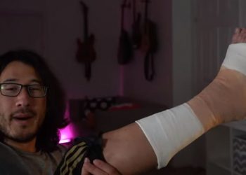 youtube-personality-markiplier-breaks-foot