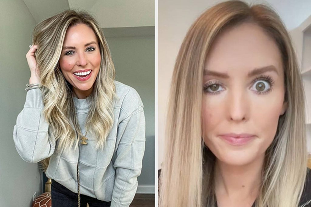 an-influencer-has-been-sharing-her-botched-botox-on-instagram-stories-and-followers-can't-…