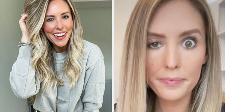 an-influencer-has-been-sharing-her-botched-botox-on-instagram-stories-and-followers-can't-…