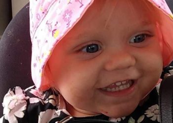facebook-fundraiser-started-for-1-year-old-severely-burned-in-wadena-county-house-fire