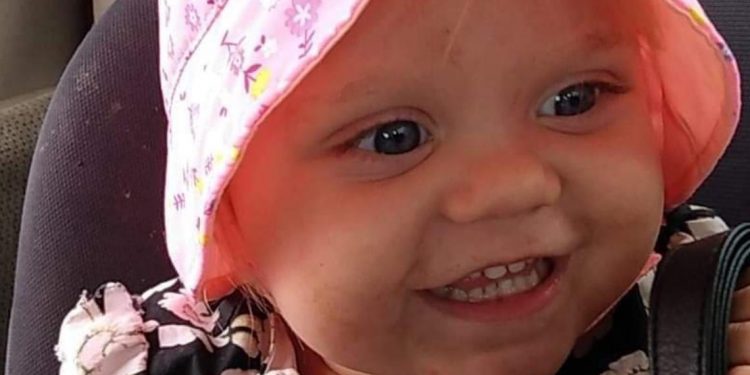facebook-fundraiser-started-for-1-year-old-severely-burned-in-wadena-county-house-fire