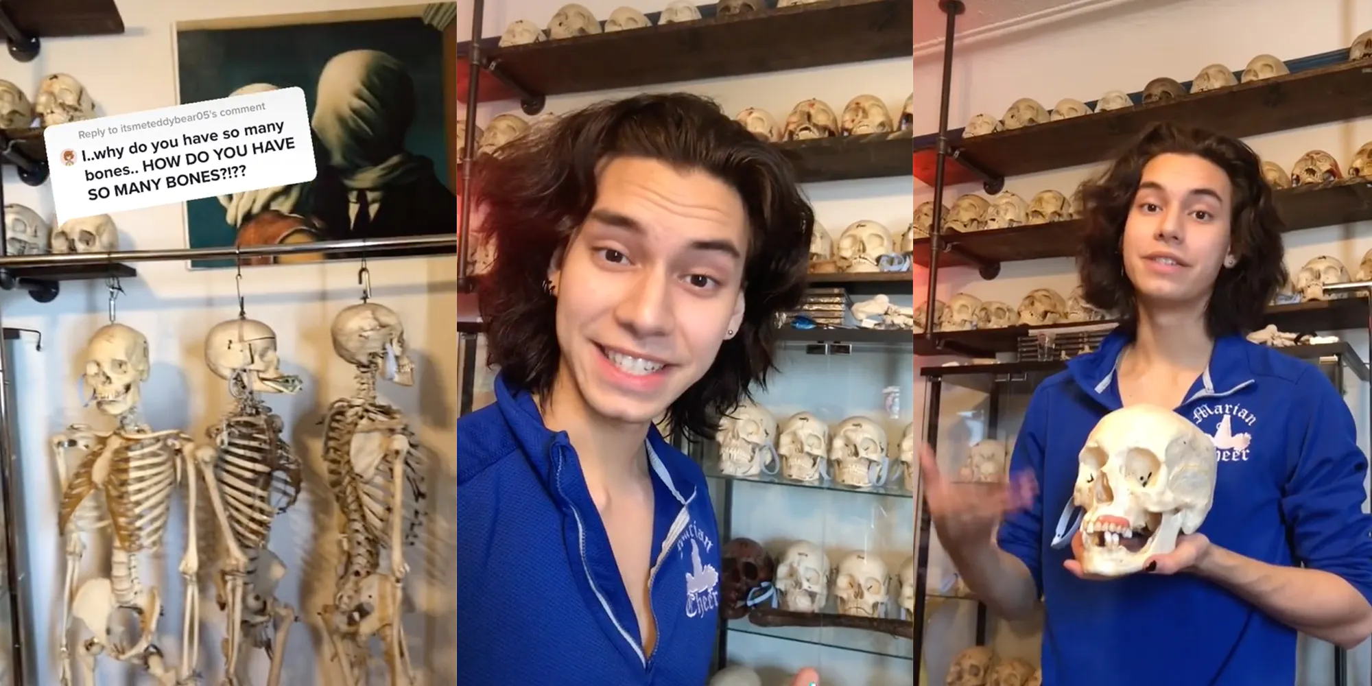'whose-bones-are-those?':-people-have-questions-about-this-tiktoker's-skull-collection