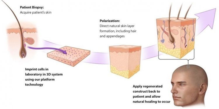 manufacturing-issues-force-delay-for-polarityte's-skin-repair-hopeful-|-fiercepharma