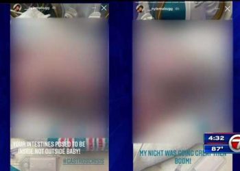 nicu-nurse-at-jmh-accused-of-posting-pictures-of-newborn-with-birth-defect-on-instagram-–-wsvn