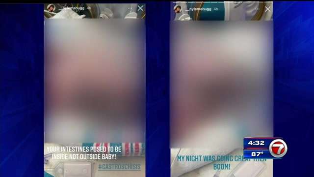 nicu-nurse-at-jmh-accused-of-posting-pictures-of-newborn-with-birth-defect-on-instagram-–-wsvn