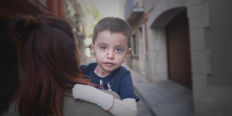 some-spanish-children-suffer-from-one-of-the-world's-rarest-diseases-–-euro-weekly-news