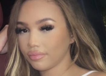 woman,-21,-left-scared-to-go-out-after-being-beaten-up-by-man-at-a-nightclub-–-plainsmen-post