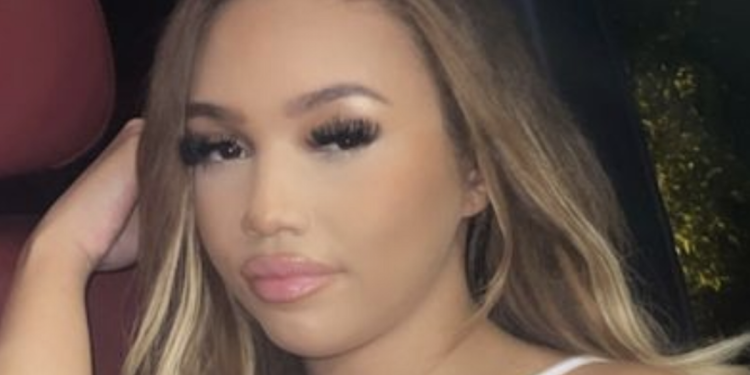 woman,-21,-left-scared-to-go-out-after-being-beaten-up-by-man-at-a-nightclub-–-plainsmen-post