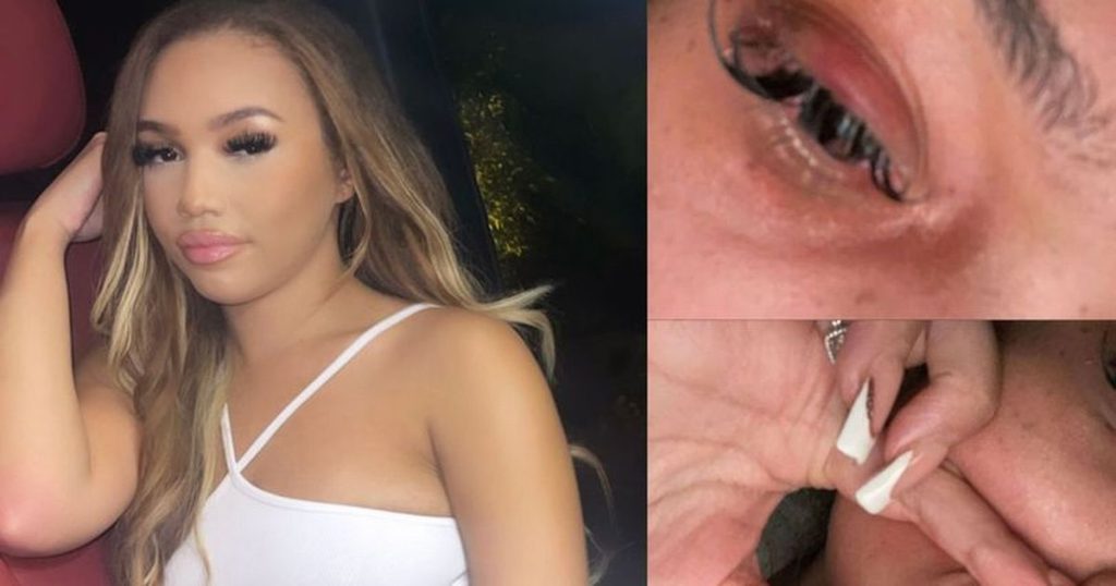 birmingham-woman-punched-by-man-on-new-year's-eve-night-out-says-she-is-'scared-to-go-out'