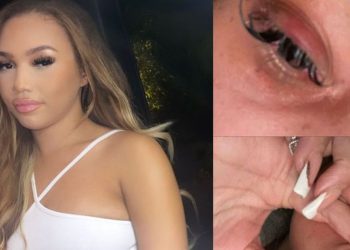 birmingham-woman-punched-by-man-on-new-year's-eve-night-out-says-she-is-'scared-to-go-out'