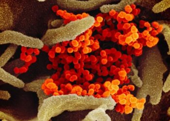 covid-19-genetic-risk-variant-protects-against-hiv,-says-study-–-deccan-chronicle