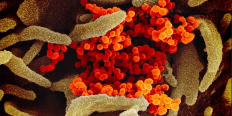 covid-19-genetic-risk-variant-protects-against-hiv,-says-study-–-deccan-chronicle