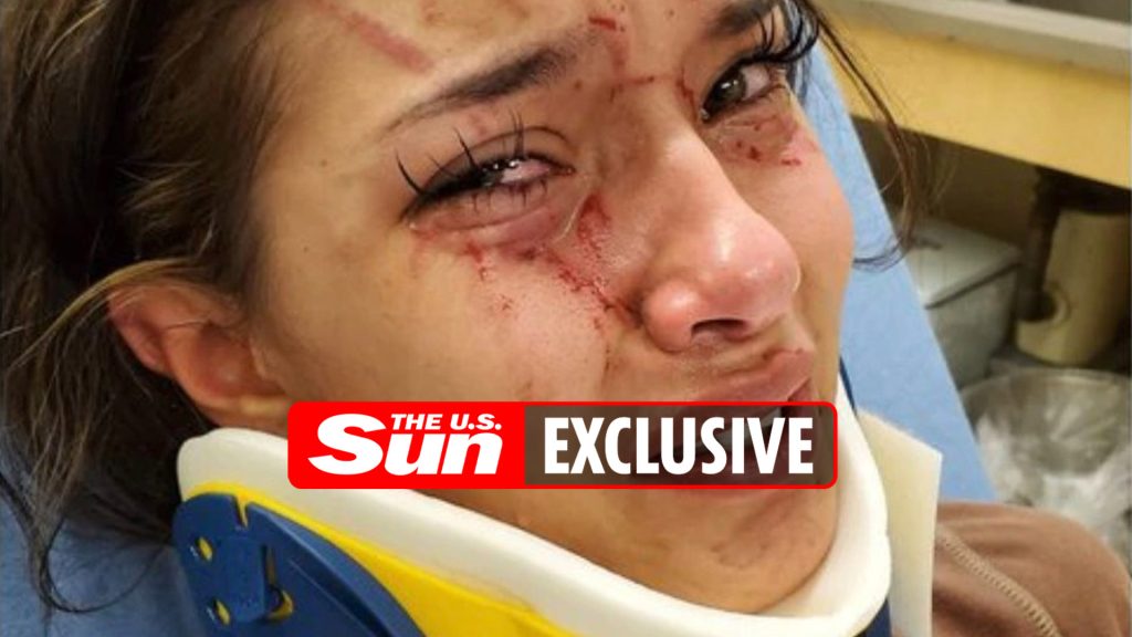 my-17-year-old-daughter-was-“lured-to-park-by-a-best-friend-and-beaten-while-a-pal-filmed-…