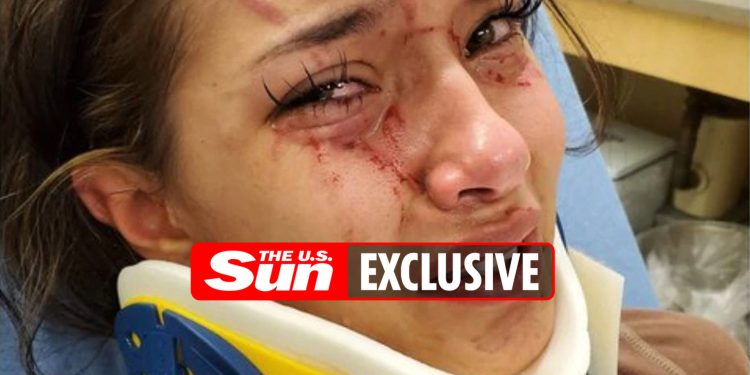 my-17-year-old-daughter-was-“lured-to-park-by-a-best-friend-and-beaten-while-a-pal-filmed-…