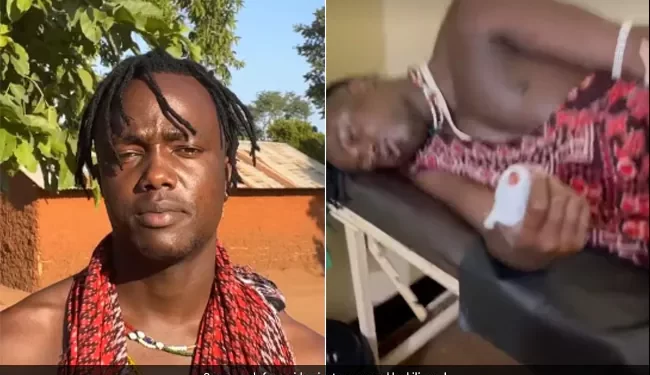 kili-paul,-internet-sensation,-attacked-with-knife-–-ndtv.com
