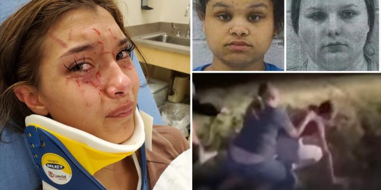 teen-girl,-17,-attacked-over-boy-in-fight-posted-on-snapchat,-mom-speaks-out