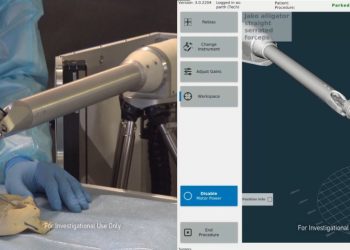 galen-robotics-looks-to-assist-ent-surgeons-with-new-bot-and-$15m-round-|-techcrunch