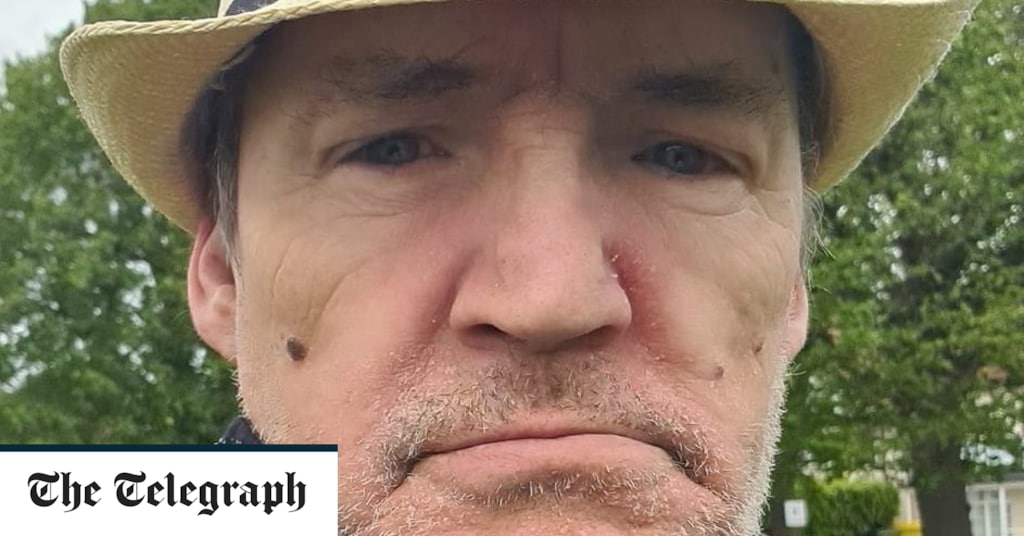 dover-petrol-bomber-ranted-about-migrants-in-racist-facebook-posts-–-the-telegraph