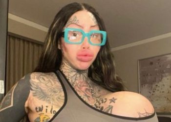 instagram-model-goes-viral-after-revealing-her-38j-breast-implant-popped-|-complex