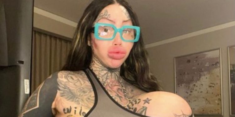 instagram-model-goes-viral-after-revealing-her-38j-breast-implant-popped-|-complex