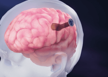 new-brain-implant-is-five-times-thinner-than-a-human-hair-–-breaking-latest-news