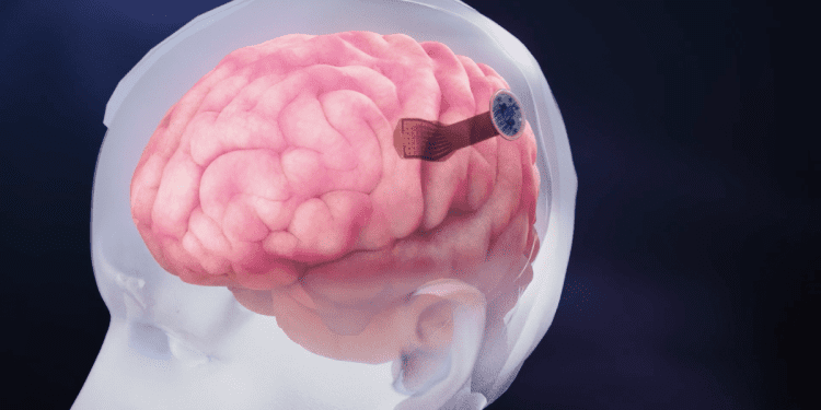 new-brain-implant-is-five-times-thinner-than-a-human-hair-–-breaking-latest-news