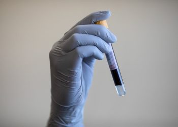 youtube-science-star-derek-muller-confronts-pfas-“forever-chemicals”—in-his-own-blood
