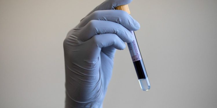 youtube-science-star-derek-muller-confronts-pfas-“forever-chemicals”—in-his-own-blood