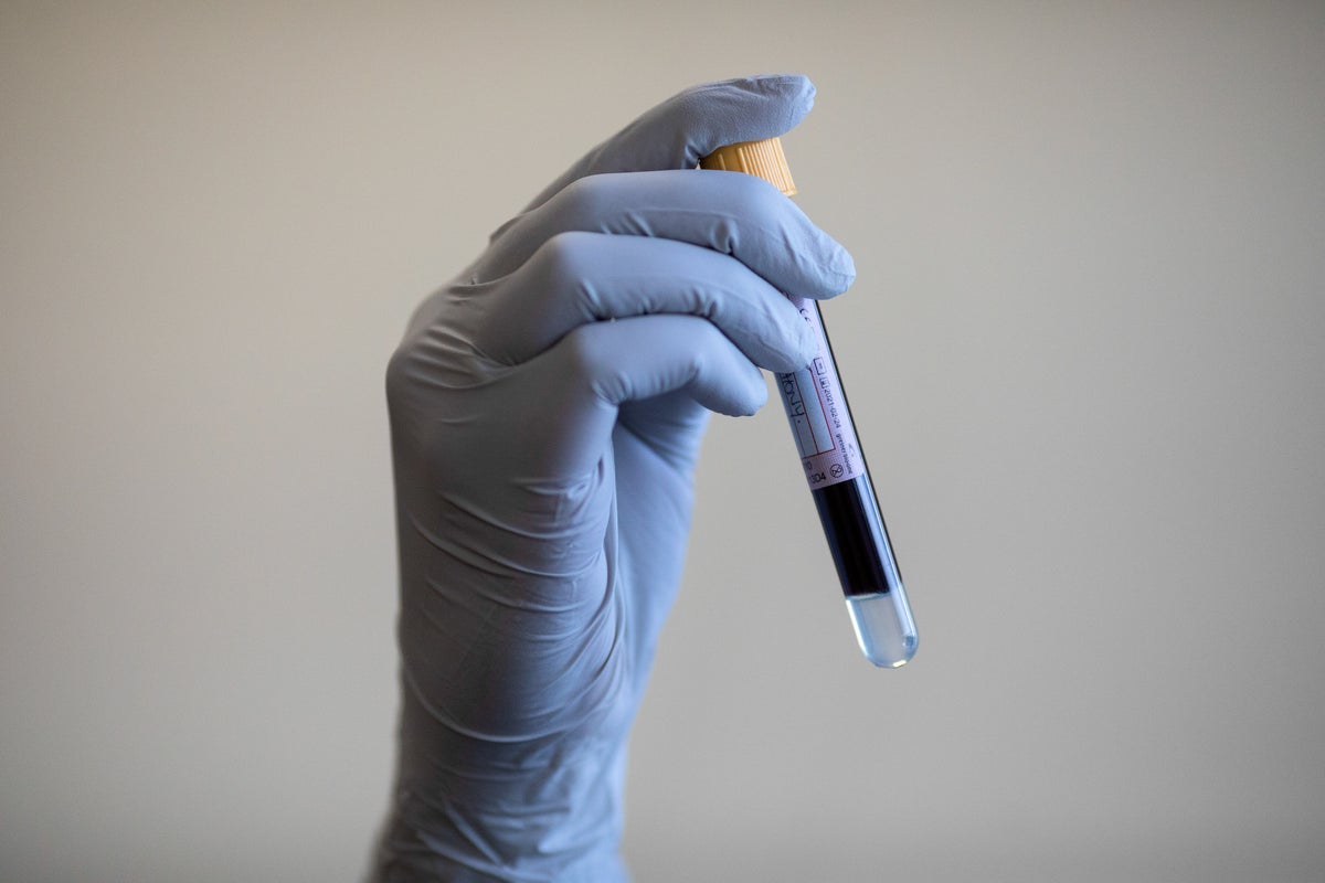 youtube-science-star-derek-muller-confronts-pfas-“forever-chemicals”—in-his-own-blood