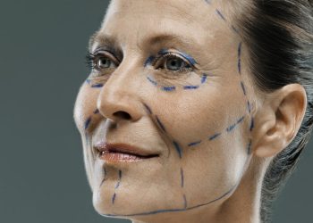 what-even-is-a-deep-plane-facelift?-–-the-cut