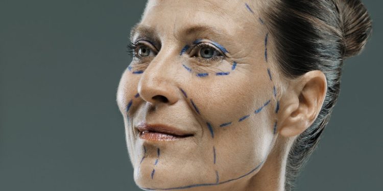 what-even-is-a-deep-plane-facelift?-–-the-cut