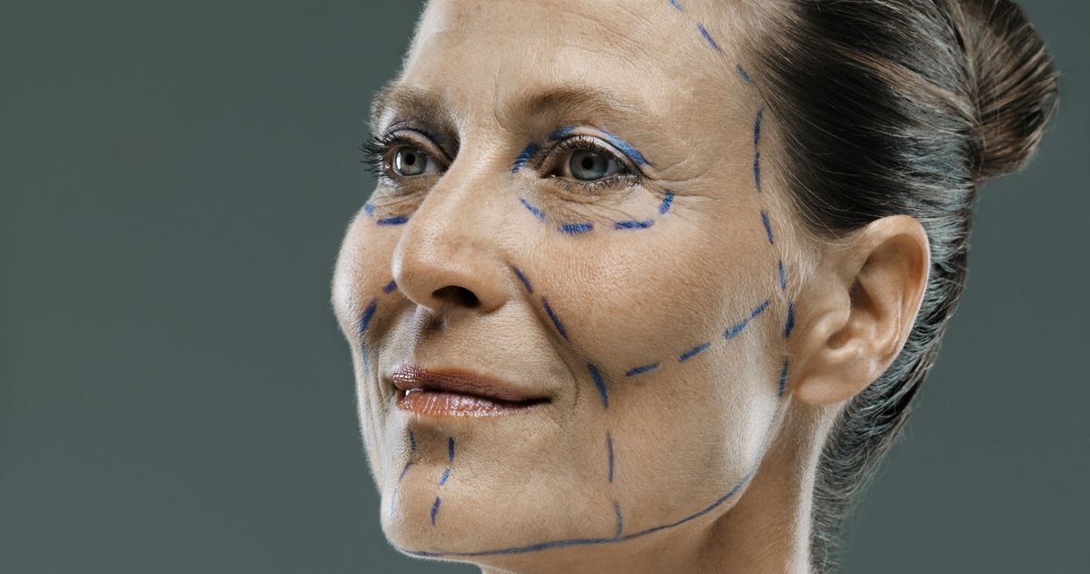 what-even-is-a-deep-plane-facelift?-–-the-cut