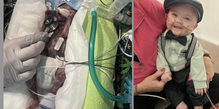 guinness-record-holder-for-most-premature-baby-is-thriving-at-1-year-old–and-all-giggles-…