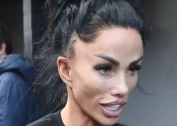katie-price-shares-cosmetic-update-as-new-procedure-leaves-visible-marks