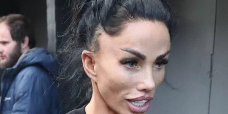 katie-price-shares-cosmetic-update-as-new-procedure-leaves-visible-marks