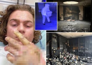 teen-accused-of-torching-mississippi-synagogue-posted-hospital-selfie-of-severe-burns-…
